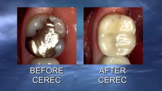 Dr. Christian speaking about CEREC CAD/CAM Technology on American Health Front thumbnail